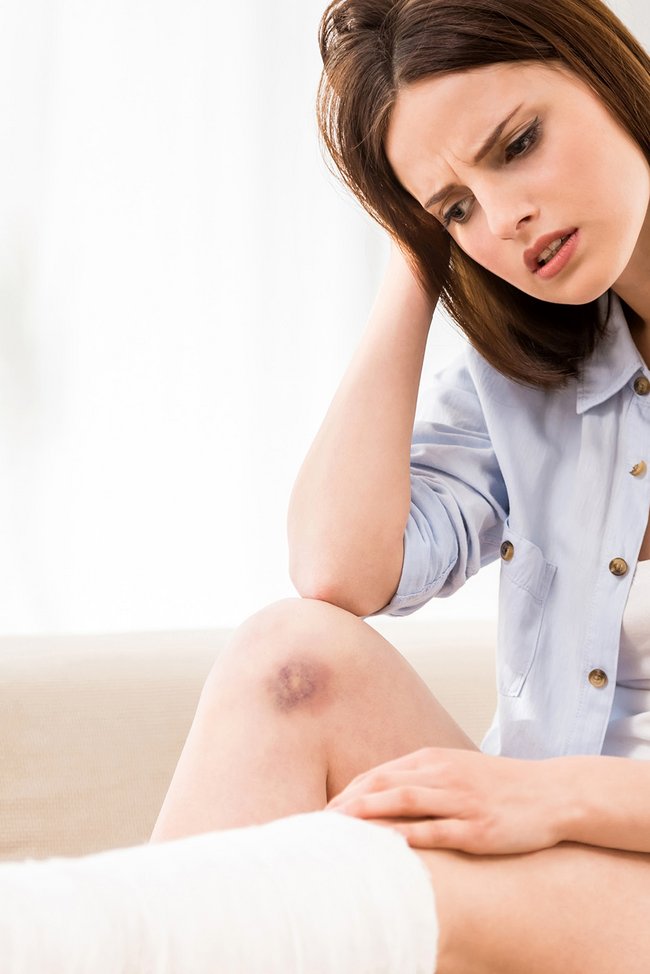 Mann mit gebrochenem Bein sitzt auf der Couch.